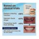 thumbnail image 4 of Prótesis dentales de silicona compatibles con Glidewellpd Smileasego, prótesis dentales completas de ajuste cómodo y regulable -YT4_, 4 of 5