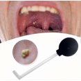 thumbnail image 1 of Tonsil Stone Remover Vacuum, Tonsil Stone Removal Kit Tool Tonsil Stone Treatment Oral Suction Tool, Dental Suction Mouth Cleaner Mouth Cleaning Oral, 1 of 4