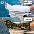 thumbnail image 7 of COEQINE Mushroom Leg Cast Covers Foot Cast Cover Knee Cast Sock Leg Plaster Sleeve Stretch Fabric Leg Cast Protector Reusable Cast Covers for Shower Leg Gifts for Friends Medium, 7 of 7