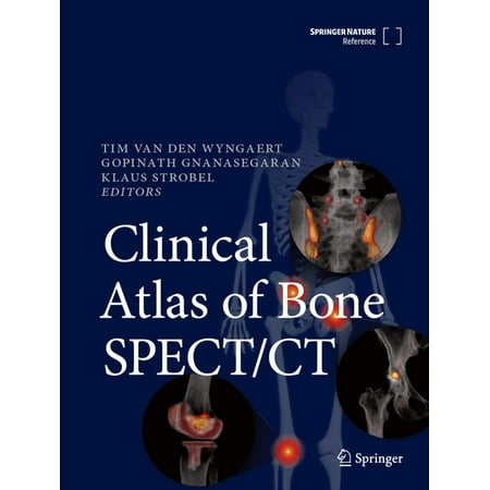 Clinical Atlas of Bone Spect/CT (Hardcover)