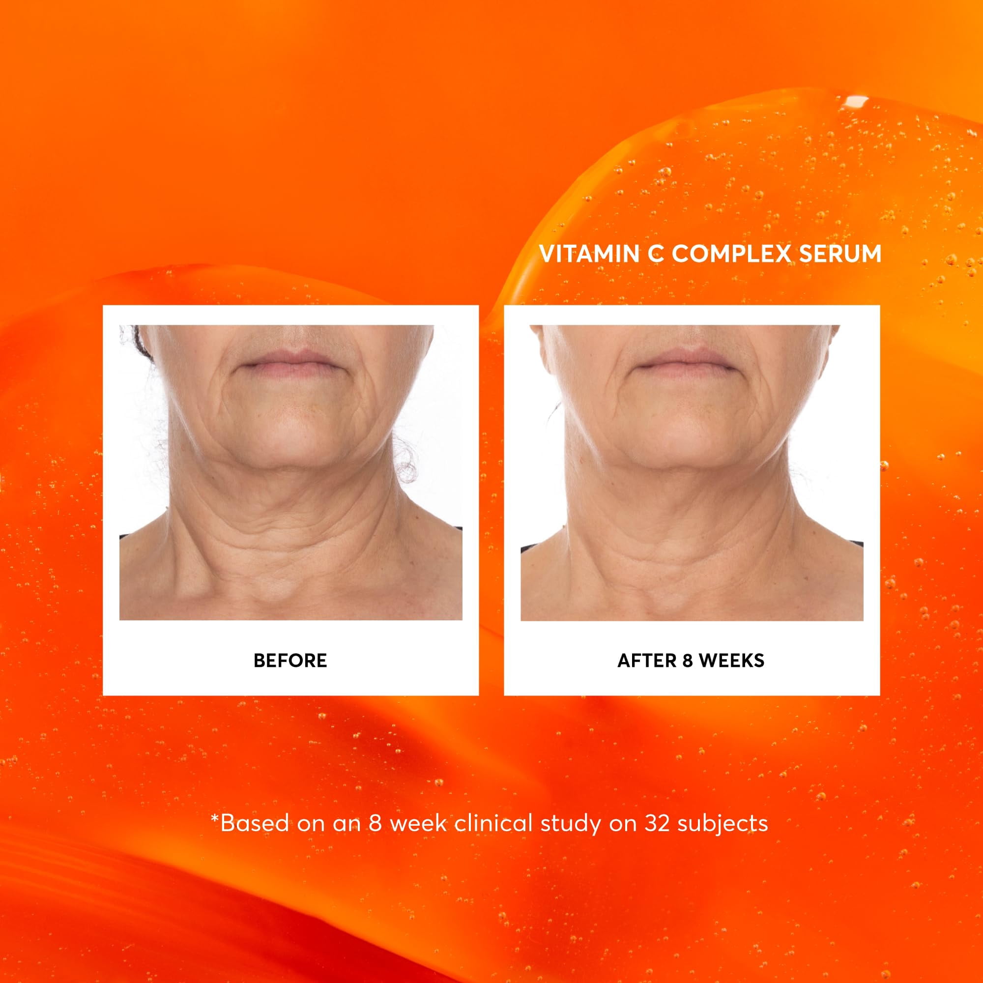 Naturium Vitamin C Complex Face Serum Jumbo, Anti-Aging Facial Treatment with Hyaluronic Acid & Vitamin E, 2 fl oz