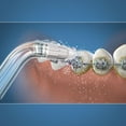 thumbnail image 2 of Waterpik® Orthodontic Tip, 2 of 2