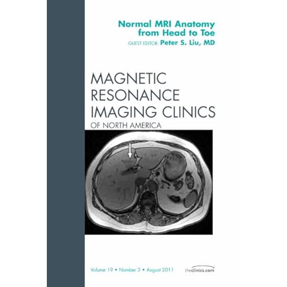 Pre-Owned Normal MR Anatomy from Head to Toe, An Issue of Magnetic Resonance Imaging Clinics (Volume 19-3) (The Clinics: Radiology, Volume 19-3), 9781455710355, 1455710350, Hardcover, 1 edition