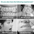 thumbnail image 3 of 10 Pack Braces Wax Dental Wax for Braces & Aligners - Food Grade HK, 3 of 5