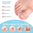 thumbnail image 4 of Juanete férula dedo gordo del pie correctores perilla Hallux Valgus negro, 4 of 9
