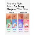 thumbnail image 4 of Set de parches para espinillas DeEasyDerm EasyDerm Multi-Step + Extractor, 4 of 9