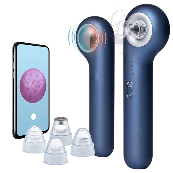 Visual Facial Blackhead Vacuum Cleaner With Cooling And Heating Compress Functions, 10X Real Time Camera Monitoring Pore Cleaner With 4 Interchangeable Heads