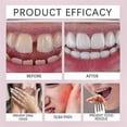 thumbnail image 5 of Thermoplastic Denture Cushion Adhesive for Secure Fit, Upper and Lower Denture Refit Solution, 5 of 5