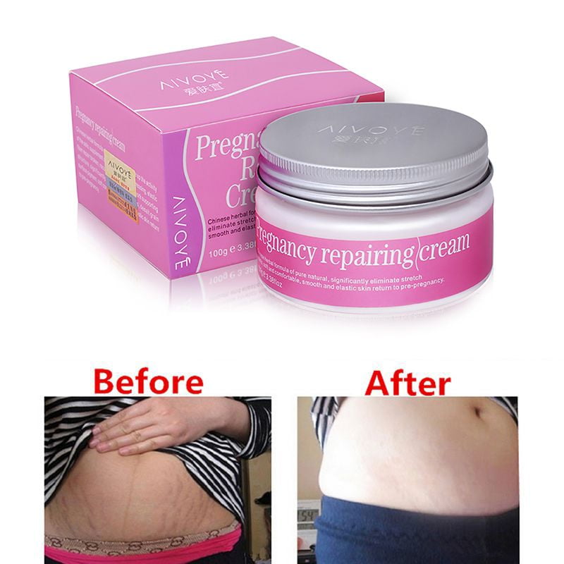 SUPERHOMUSE Stretch Mark Pregnancy Repairing Cream Lightening Pigment Brighten Skin Color