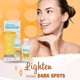 thumbnail image 2 of Loción Bye Bye Bye Blemish Dark Spot Vitamina C 30 ml, 2 of 4