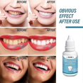 thumbnail image 2 of Of Teeth Remove Yellow Teeth Black Teeth Tooth Teeth Fresh Breath Bright White Brightening Teeth, 2 of 4