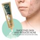 thumbnail image 2 of Scar and scar mark removal ointment cream, 2 of 5