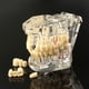 thumbnail image 1 of 2025 Modelos dentales Modelos de resina reparables de dientes enfermos para la enseñanza y la investigación en medicina y enfermedades dentales, 1 of 5