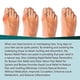 thumbnail image 4 of Gout Treatment Patch Finger Bunion Pain Relief Plaster Foot Bone Thumb Corrector, 4 of 5