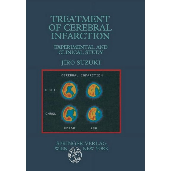 Treatment of Cerebral Infarction: Experimental and Clinical Study, (Paperback)