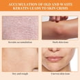 thumbnail image 2 of Gel exfoliante de naranja TPTAL para rostro y cuerpo 50 g, 2 of 7