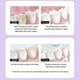 thumbnail image 2 of 3x Pasta de dientes blanca Dientes blancos brillantes Pasta de dientes refrescante para prevenir la caries dental Seguridad de alta calidad, 2 of 4