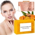 thumbnail image 2 of 3pcs Ginger Yellow Soap+Cleansing Mousse Set,Natural Usman Grass Solid Shampoo Soap,Plant-Based Hair Cleanser with Herbal Extracts,120g, 2 of 10