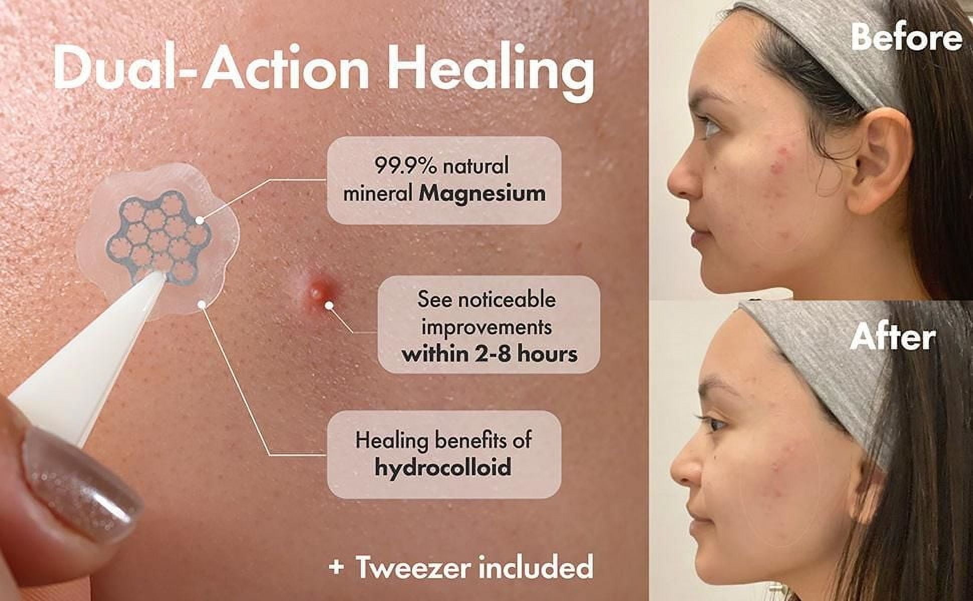 FREEGO MAGNESIUM PATCH - MINI (15EA/PACK)