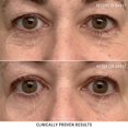 thumbnail image 4 of BIOSSANcE Crème pour les Yeux au Squalane et aux Algues Marines Crème Riche Anti-Âge pour le Visage Soulève, Raffermit et Lisse les Ridules et les Rides 05 Onces, 4 of 6