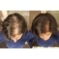 thumbnail image 3 of Zenagen Revolve Shampoo For Women | Supports Scalp Health & Appearance of Fuller, Healthier-Looking Hair, Developed for Fine & Visibly Thinning Hair,, 3 of 4