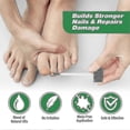 thumbnail image 5 of 30ml Toenail Fungus Treatment, Tea Tree Oil For Toenail Fungus, Antifungal Nail Solution Care Essence, 5 of 5