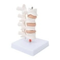 thumbnail image 4 of Human Osteoporosis Modelsafe, Eco-friendly Durable Osteoporosis Model Firm  For Teaching For Model Display For Doctor-patient Explanation, 4 of 8