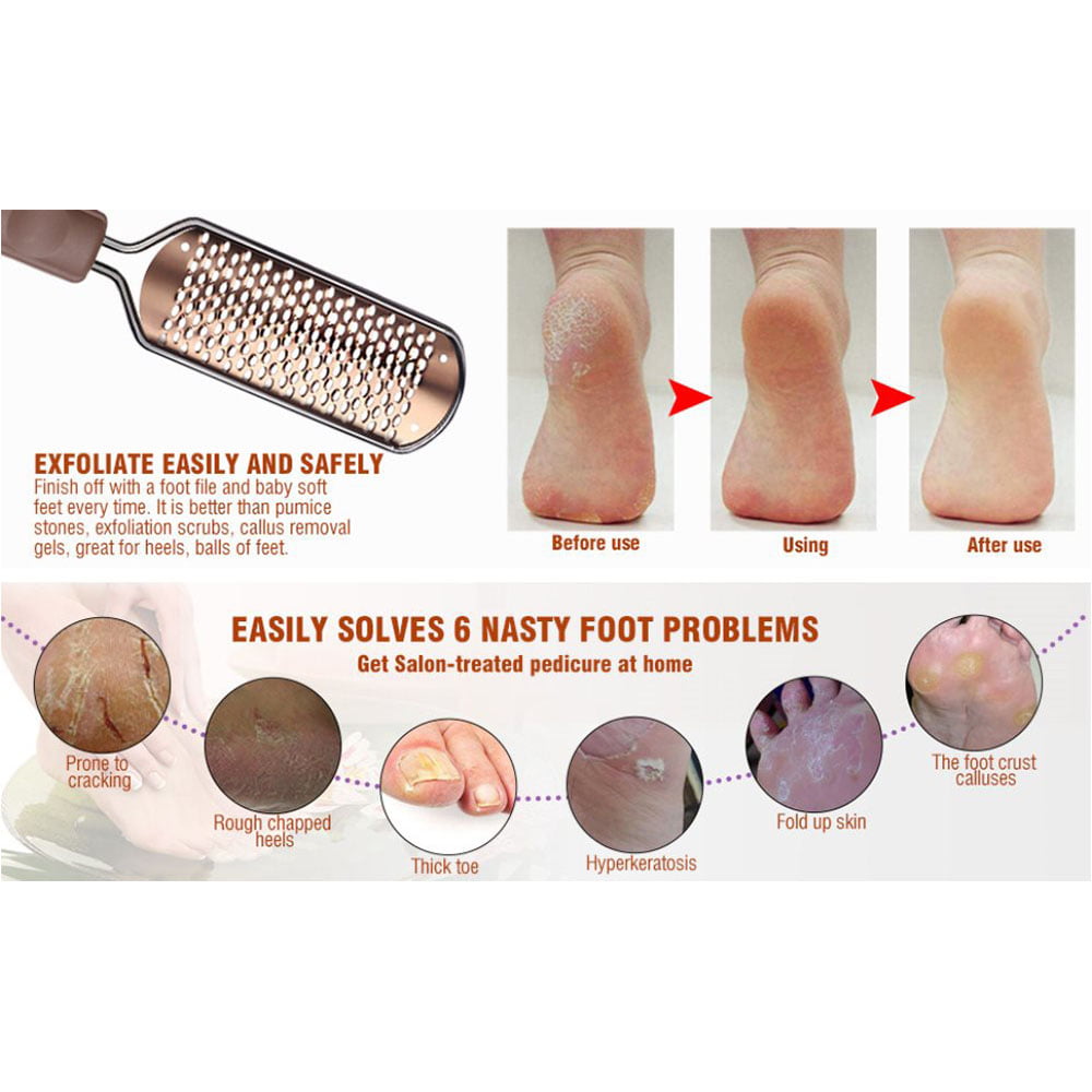 👣 Pedicure Tutorial Callus Removal on Ball of Foot and Foot