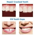thumbnail image 5 of Juego de mordedores para rellenar los agujeros de los dientes, para dentaduras postizas, maquillaje, accesorios de escenario, adhesivo de plástico para relleno dental., 5 of 5