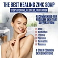 Pyrithione Zinc Soap Bar for Face & Body, 4oz 2 ZnP Bar Soap Skin Repair Cleanser for Acne