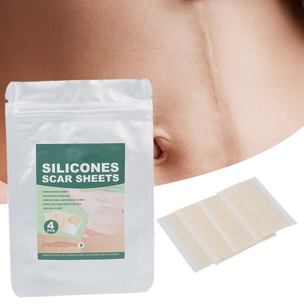 Silicone Scar Gel Sheets, Safe Professional Scar Gel Strips For