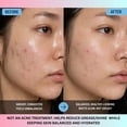 thumbnail image 3 of Full On Hydration Face Moisturizer – Matte Finish for Oily & Combination Skin | Oil Control & Shine Reduction, 3 of 12