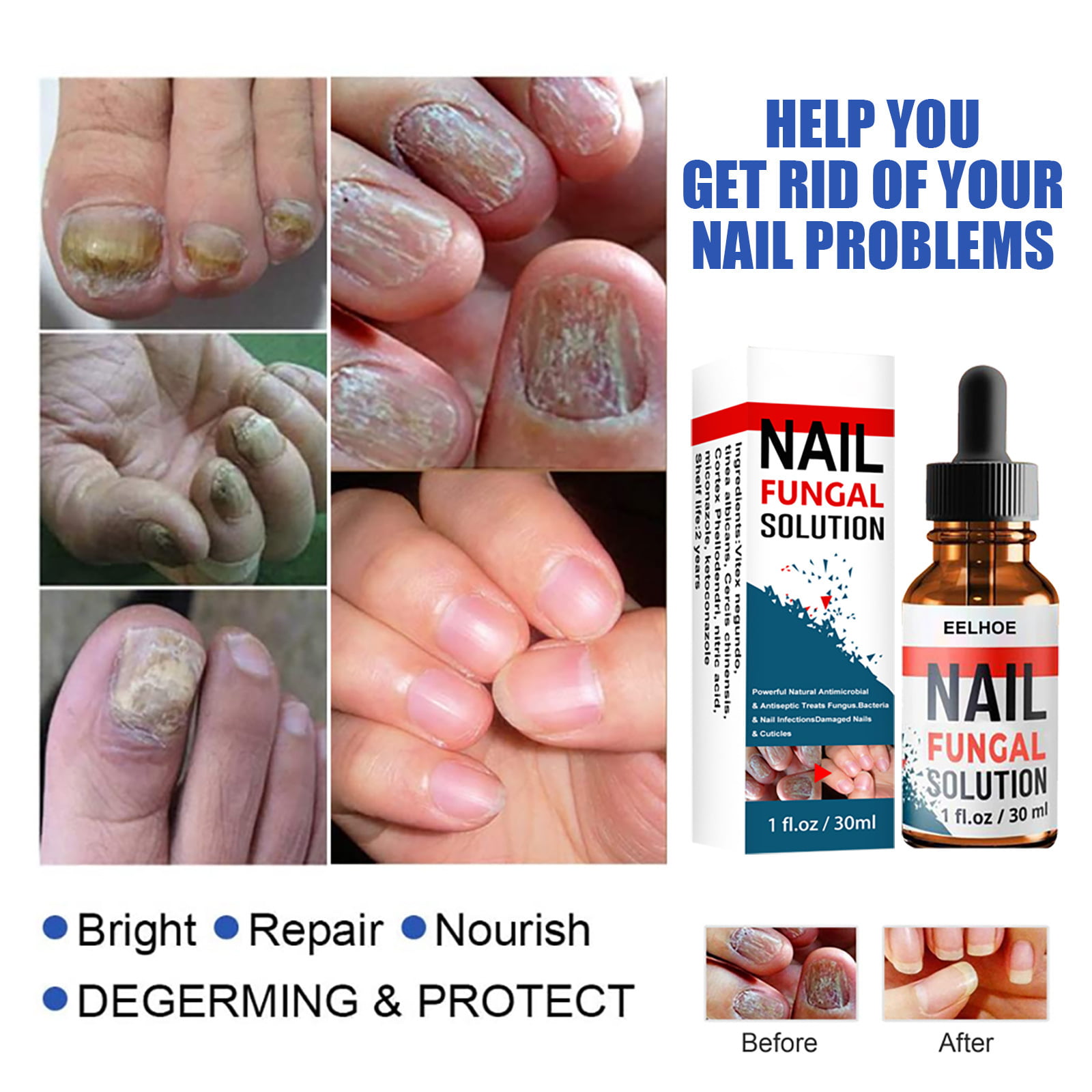 Amazon.com : Bright Nail Repair Best Toenail Fungus Medicat Infection  Treatment, 10 mL : Beauty & Personal Care