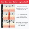 thumbnail image 5 of iRestore Laser Hair Growth System FDA Cleared Hair Loss Treatment for Men and Women, 5 of 9