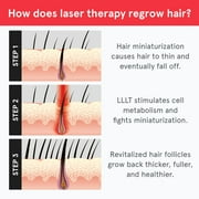 iRestore Laser Hair Growth System FDA Cleared Hair Loss Treatment for Men and Women