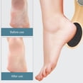 thumbnail image 3 of Foot File Callus Remover-multi Purpose 4 In 1 Feet Pedicure Kit With Foot Care Bristle Brush,pumice Stone,foot Rasp,sand Paper, 3 of 5