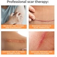 thumbnail image 3 of Strataderm Professional Scar Therapy Gel, for Old and New Scars, 5g / 0.17 oz, 3 of 8