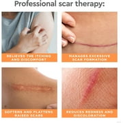 Strataderm Professional Scar Therapy Gel, for Old and New Scars, 5g / 0.17 oz