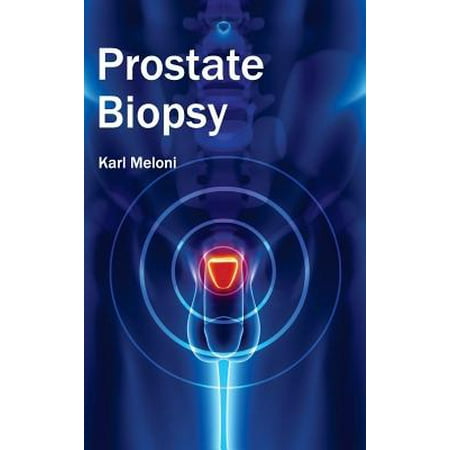 Biopsy Forcep - Prostate Biopsy