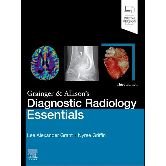 Grainger & Allison's Diagnostic Radiology Essentials, (Hardcover)