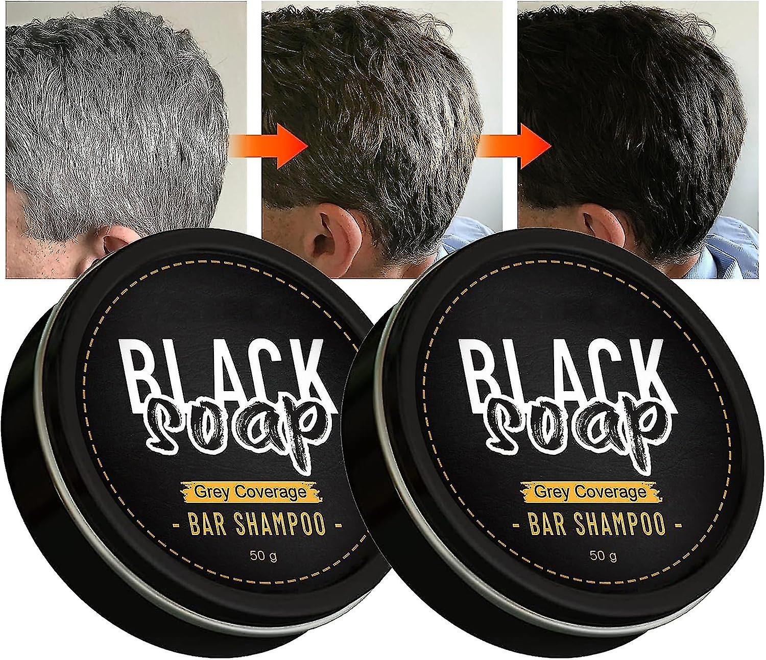 Top 156+ hair removal soap ayurvedic best dedaotaonec