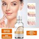 thumbnail image 4 of Suero blanqueador Facial que elimina las manchas y pecas de la edad de melanina, reduce la luminosidad, hidrata, ilumina el cuidado Facial, 4 of 5
