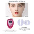 thumbnail image 1 of Masajeador Facial eléctrico adelgazante, entrenador de cara en V, ejercitador de mandíbula, levantamiento de la piel, estimulador muscular de pulso Facial EMS con almohadillas de electrodos, 1 of 4