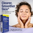 thumbnail image 2 of Adapalene Gel 0.1% USP - Skin Care Acne Medication for Sensitive Skin, Acne Treatment Solution, Paraben Free, Topical Retinoid Gel. Prescription Strength Formula - FDA Approved (0.5 oz), 2 of 9