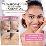 Leven Rose Rosehip Seed Oil for Face 4 oz - Pure Rosehip Oil for Face - Unrefined Cold Pressed Rosehip Oil for Body