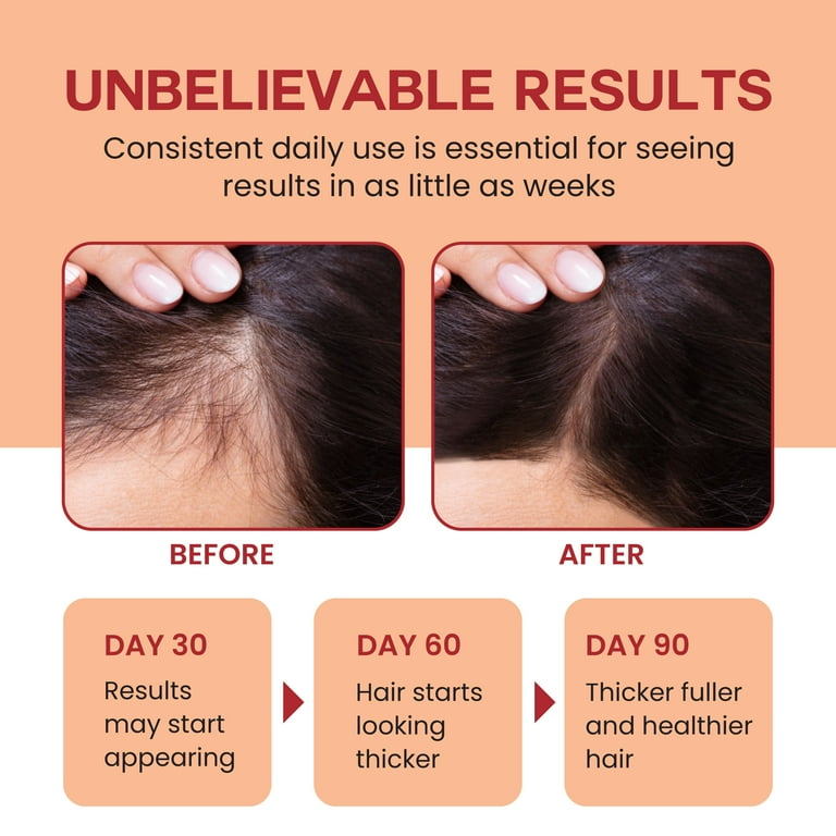 4 Fl Oz 100% Pure Batana Oil For Hair Growth – Promotes Regrowth & Healthy Hair – All Hair Types