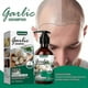thumbnail image 1 of Jaysuing garlic shampoo for itchy hair, anti-dandruff shampoo, anti-hair loss and nourishing hair BF | |, 1 of 5