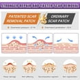 thumbnail image 3 of Silicone Scar Sheets,Silicone Scar Tape,Silicone Scar Removal Strips for Surgical,C-Section,Tummy Tuck,Keloid Scars (1.6"X 59" Roll-1.5M) Keloid Bump Removal, 3 of 8