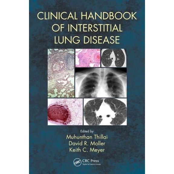 Clinical Handbook of Interstitial Lung Disease, (Paperback)