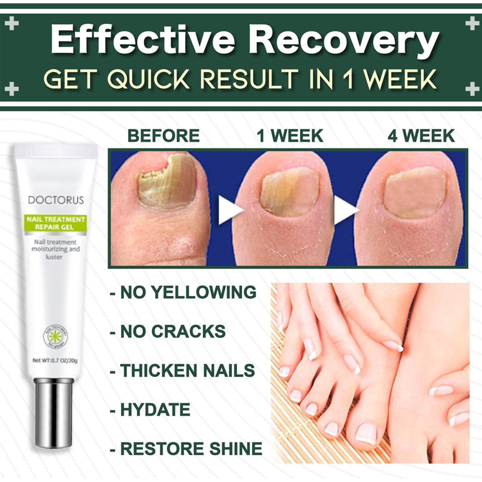 EFERO AntiFungal Nail Gel AntiInfection Nails Treatment Hand Foot
